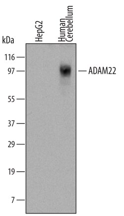 Human ADAM22 Antibody, R D Systems 25&mu;g; Unlabeled:Antibodies, Monoclonal
