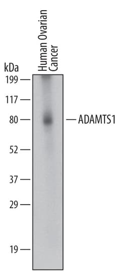 Human ADAMTS1 Antibody, R D Systems 100ug; Unlabeled:Antibodies, Monoclonal