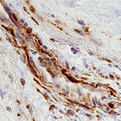 Human/Mouse ADAMTS15 Antibody, R D Systems 100 &mu;g | Buy Online | R&D Systems | Fisher Scientific