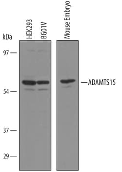 Human/Mouse ADAMTS15 Antibody, R D Systems 100 &mu;g | Buy Online | R&D Systems | Fisher Scientific