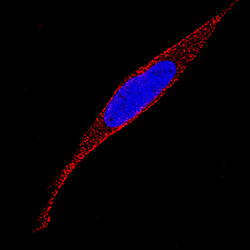 Human ADAMTS4 MAb (Clone 416610), R D Systems 500ug; Unlabeled:Antibodies,