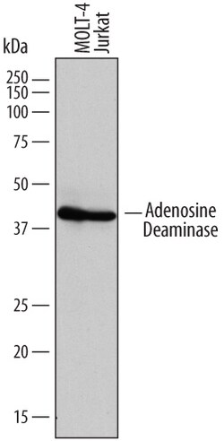 Human/Mouse Adenosine Deaminase/ADA Antibody, R D Systems 100&mu;g; Unlabeled:Antibodies,