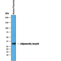 Human Adiponectin/Acrp30 Antibody, R D Systems 100&mu;g; Unlabeled:Antibodies,
