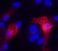Mouse Adiponectin/Acrp30 Antibody, R D Systems 25&mu;g; Unlabeled:Antibodies,