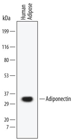 Human Adiponectin/Acrp30 Antibody, R D Systems 100ug; Unlabeled:Antibodies,