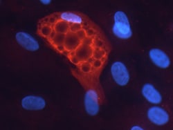 Human Adiponutrin/PNPLA3 Antibody, R D Systems 100&mu;g; Unlabeled:Antibodies,