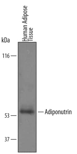 Human Adiponutrin/PNPLA3 Antibody, R D Systems 100&mu;g; Unlabeled:Antibodies,