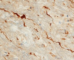 Human ADNP Antibody, R D Systems 100&mu;g; Unlabeled:Antibodies, Polyclonal