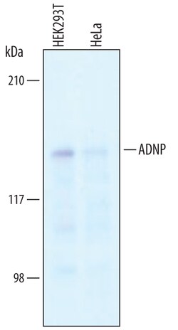 Human ADNP Antibody, R D Systems 100&mu;g; Unlabeled:Antibodies, Polyclonal