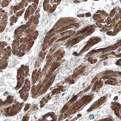 Human Adrenomedullin/ADM Antibody, R D Systems 25&mu;g; Unlabeled:Antibodies,