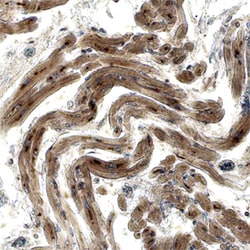Human Adrenomedullin/ADM Antibody, R D Systems 100ug; Unlabeled:Antibodies,