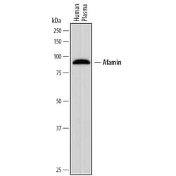 Human Afamin Antibody, R D Systems 25&mu;g; Unlabeled:Antibodies, Polyclonal
