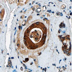 Human AG-3 Antibody, R D Systems 25&mu;g; Unlabeled:Antibodies, Polyclonal