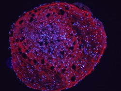 Human Aggrecan G1-IGD-G2 Domains Antibody, R D Systems 25&mu;g; Unlabeled:Antibodies,