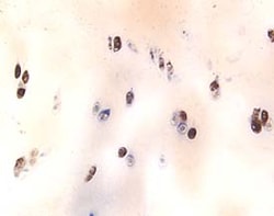 Human Aggrecan G1-IGD-G2 Domains Antibody, R D Systems 25&mu;g; Unlabeled:Antibodies,