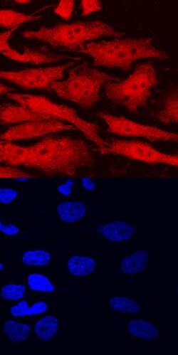 Human AHR Antibody, R D Systems 100&mu;g; Unlabeled:Antibodies, Polyclonal