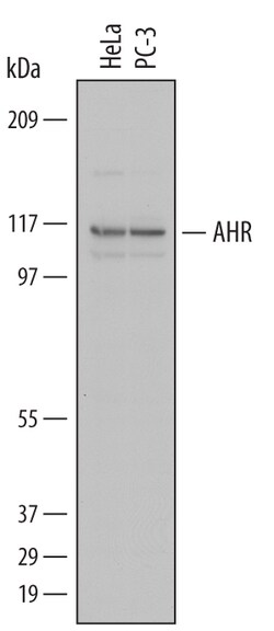 Human AHR Antibody, R D Systems 100&mu;g; Unlabeled:Antibodies, Polyclonal