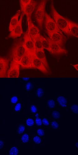 Mouse AHR Antibody, R D Systems 100&mu;g; Unlabeled:Antibodies, Polyclonal