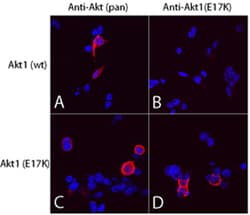 Human Akt1 (E17K Mutation) Antibody, R D Systems 25&mu;g; Unlabeled:Antibodies,