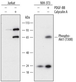Human Phospho-Akt1 (T308) Antibody, R D Systems 100 &mu;g | Buy Online | R&D Systems | Fisher Scientific
