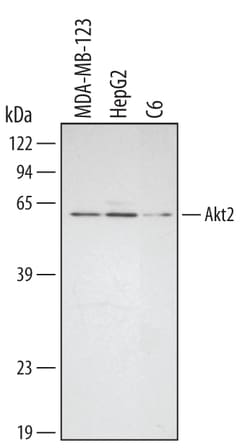 Human/Mouse/Rat Akt2 Antibody, R D Systems 50&mu;g; Unlabeled:Antibodies,