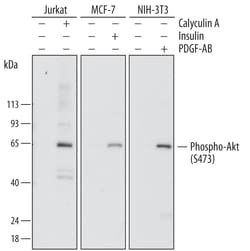 Human/Mouse Phospho-Akt (S473) Pan Specific Antibody, R D Systems 100ug;