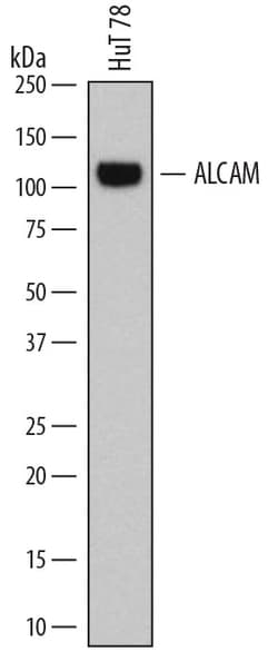 Human ALCAM/CD166 Antibody, R D Systems:Antibodies:Primary Antibodies