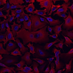 Human/Mouse Aldehyde Dehydrogenase 1-A1/ ALDH1A1 Antibody, R D Systems