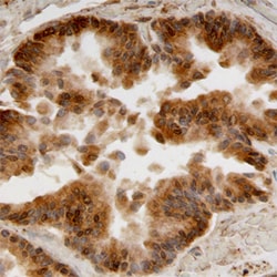 Human/Mouse Aldehyde Dehydrogenase 1-A1/ ALDH1A1 Antibody, R D Systems