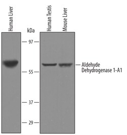 Human/Mouse Aldehyde Dehydrogenase 1-A1/ ALDH1A1 Antibody, R D Systems