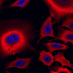Human Aldehyde Dehydrogenase 1-A1/ ALDH1A1 Antibody, R D Systems 100ug;