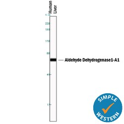 Human Aldehyde Dehydrogenase 1-A1/ ALDH1A1 Antibody, R D Systems 100ug;
