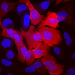 Human Aldehyde Dehydrogenase 3-A1/ALDH3A1 Antibody, R D Systems 25&mu;g;