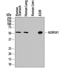 Human Aldehyde Dehydrogenase 3-A1/ALDH3A1 Antibody, R D Systems 25&mu;g;