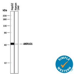 Human Aldo-keto Reductase 1C1/AKR1C1 Antibody, R D Systems 25&mu;g; Unlabeled:Antibodies,
