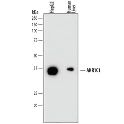 Human Aldo-keto Reductase 1C1/AKR1C1 Antibody, R D Systems 25&mu;g; Unlabeled:Antibodies,