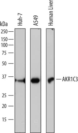Human Aldo-keto Reductase 1C3/AKR1C3 Antibody, R D Systems 100&mu;g; Unlabeled:Antibodies,