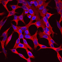 Human Aldo-keto Reductase 1C3/AKR1C3 Antibody, R D Systems 25&mu;g; Unlabeled:Antibodies,