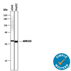Human Aldo-keto Reductase 1C3/AKR1C3 Antibody, R D Systems 25&mu;g; Unlabeled:Antibodies,