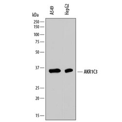 Human Aldo-keto Reductase 1C3/AKR1C3 Antibody, R D Systems 25&mu;g; Unlabeled:Antibodies,