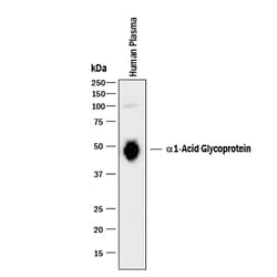 Human alpha 1-Acid Glycoprotein Antibody, R D Systems 25&mu;g; Unlabeled:Antibodies,