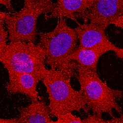 Mouse/Rat alpha 1B-Glycoprotein Antibody, R D Systems 100&mu;L:Antibodies,