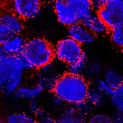 Human alpha 2-Macroglobulin Antibody, R D Systems 25&mu;g; Unlabeled:Antibodies,