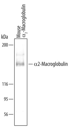 Mouse alpha 2-Macroglobulin Antibody, R D Systems 100 &mu;g | Buy Online | R&D Systems | Fisher Scientific