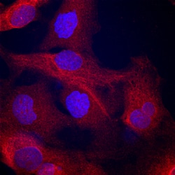Human/Mouse/Rat alpha-Actinin 1 Antibody, R D Systems:Antibodies:Primary