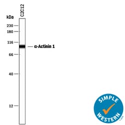 Human/Mouse/Rat alpha-Actinin 1 Antibody, R D Systems 100&mu;g; Unlabeled:Antibodies,