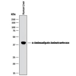 Human alpha-Aminoadipate Aminotransferase Antibody, R D Systems:Antibodies:Primary