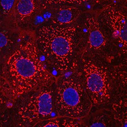 Human/Rat alpha-Fetoprotein/AFP Antibody, R D Systems 25&mu;g; Unlabeled:Antibodies,