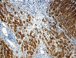 Human/Rat alpha-Fetoprotein/AFP Antibody, R D Systems 25&mu;g; Unlabeled:Antibodies,