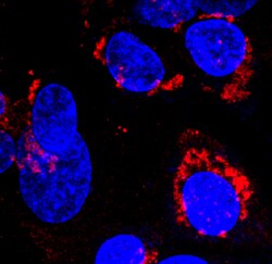 Human alpha-Fetoprotein/AFP Antibody, R D Systems 25&mu;g; Unlabeled:Antibodies,